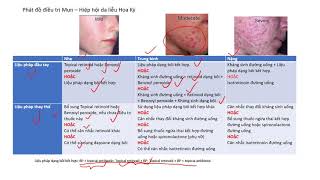 Video 2 điều trị mụn  Phát đồ điều trị mụn của hiệp hội da liễu Hoa Kỳ Acne treatment [upl. by Nagey]