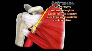 NERVE INJURY IN THE UPPER EXTREMITY Everything You Need To Know  Dr Nabil Ebraheim [upl. by Carmelita]