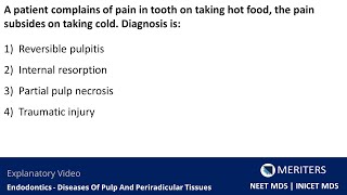 NEET MDS  INICET  Endodontics  Diseases Of Pulp And Periradicular Tissues  Explanatory Video [upl. by Olympe]