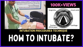 HOW TO INTUBATE INTUBATION PROCEDURE amp TECHNIQUE [upl. by Fairweather]