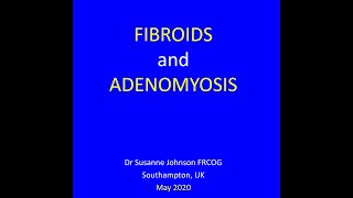 FIBROIDS AND ADENOMYOSIS [upl. by Kunz]