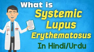 Systemic Lupus Erythematosus SLE Treatment HindiUrdu Symptoms Rheumatology Medicine Lecture [upl. by Dnomar]