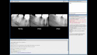 VDW Dental · Webinar The Endodontic Essentials with Dr Marino Sutedjo EN [upl. by Wit]