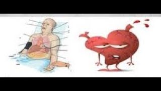 🔴 Acute decompensated heart failure for SPLE مهم جدا DrHazem Sayed [upl. by Gavra824]