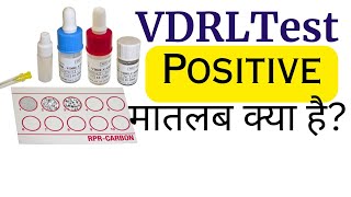 VDRL Test Hindi  VDRL test kya hota hai [upl. by Elnukeda]