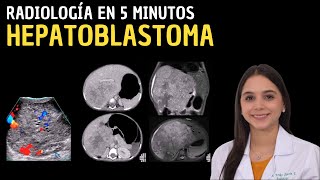 Radiología en 5 minutos Hepatoblastoma [upl. by Taryn403]