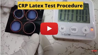 CReactive Protein Test CRP Latex Test Procedure [upl. by Senzer]