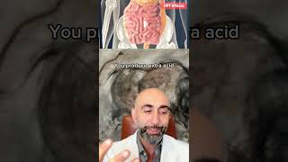 How does hyperparathyroidism affect the body Dr Babak Larian explains [upl. by Aseena]