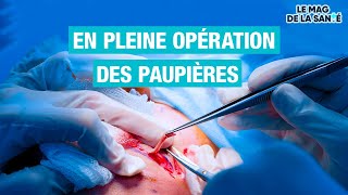 👁️ Une chirurgie pour remonter les PAUPIÈRES  Allo Docteurs [upl. by Krystle192]