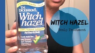 Scalp Treatment w WITCH HAZEL  Natural Hair [upl. by Inahteb46]