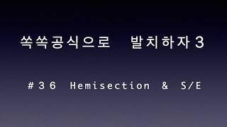 36  hemisection 단근치로 분리하여 각각 발치 [upl. by Dimitry]