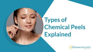 Types of Chemical Peels  Peels for Hyperpigmentation amp Acne [upl. by Rew405]