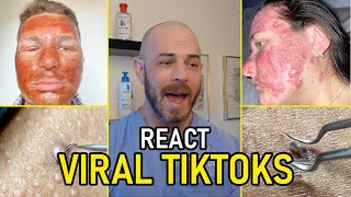 Insane Transformation Reactions  Pimple Pop amp Chemical Peel [upl. by Neelcaj391]