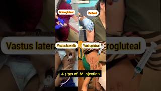 Intramuscular injection kaise lagate hai shorts [upl. by Belmonte488]