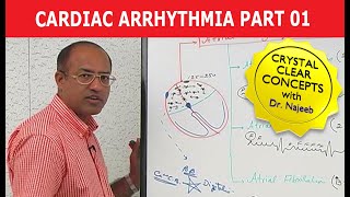 Cardiac Arrhythmia  Part 13 [upl. by Ahsiyn]