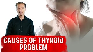 What are the Real Causes of Thyroid Problems – DrBerg [upl. by Esinej]