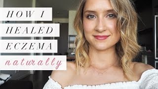 How I Healed Eczema Naturally  My Story [upl. by Retsub]