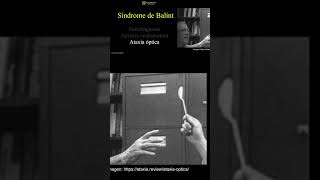 Ataxia Óptica Síndrome de Balint optometria psicologia neurologia psiquiatria [upl. by Leicam803]