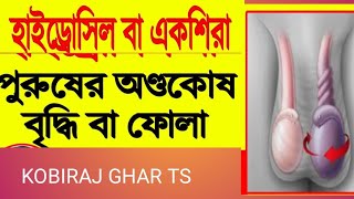 হাইড্রোসিলের অত্যন্ত কার্যকরী কবিরাজি চিকিৎসা hydrocele treatment by natural remedy [upl. by Ailemak]