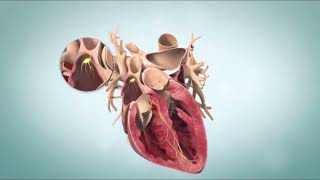 Ventricular Fibrillation VFib Terminal Cardiac Rhythm [upl. by Aksoyn]