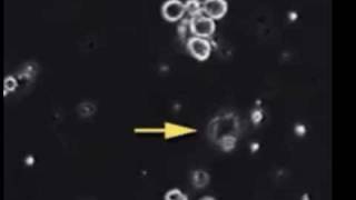 Bacteria Cell cytolysis with video cell division [upl. by Lugo]