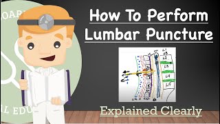 Performing a Lumbar Puncture  Anatomy Positioning Indications Contraindications Complications [upl. by Farkas395]