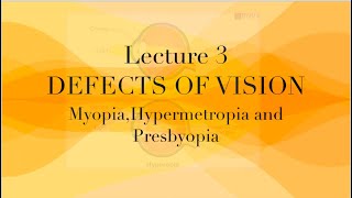 Defect of vision  class 10 presbyopia Myopia  hypermetropia [upl. by Tomasz]