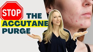 Accutane Acne Purge Do THIS [upl. by Gustin695]