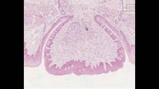 Shotgun Histology Tongue Circumvallate Papilla [upl. by Arramas459]