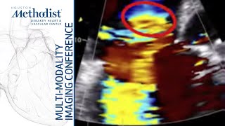 Assessment of the Right Ventricle and Right Sided Valves Echo Sherif Nagueh MD February 22 2022 [upl. by Aurora738]