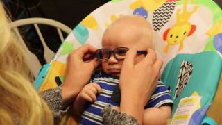 Baby with Albinism Sees Mom for First Time with Glasses [upl. by Nafets]