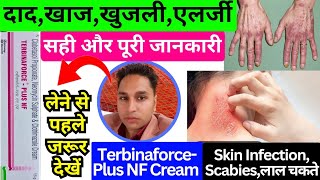 terbinaforce plus nf  terbinaforce plus nf cream ke fayde  terbinaforce plus cream  terbinaforce [upl. by Trixy]