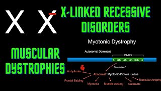 USMLE Step 1  Lesson 36  X linked Recessive disorders and Muscular Dystrophies [upl. by Fellows]