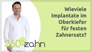 Wie viele Implantate im Oberkiefer für festen Zahnersatz  Implantate  Fragen amp Antworten 360°zahn [upl. by Eidnas]