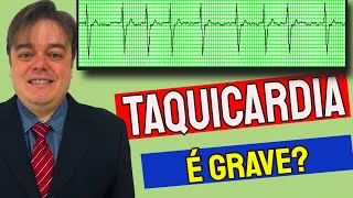 O que são taquicardias Quais os tipos mais comuns de taquicardias 2021 [upl. by Eltsyrhc]