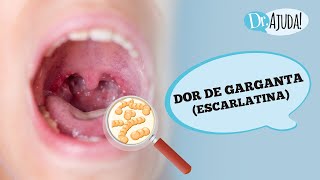 DOR DE GARGANTA E ESCARLATINA QUANDO SUSPEITAR  DIAGNÓSTICO TRATAMENTO E COMO PREVENIR [upl. by Lengel]