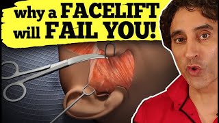 WHY A FACELIFT WILL FAIL YOU  Facelift [upl. by Eimareg97]