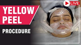 Yellow Peels  Step by Step  Peeling Treatment for Skinglow and Acne scars sakhiyaskinclinic [upl. by Sarina]