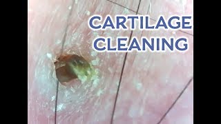 Cartilage Piercing Unclogged Located on an Ear Read Details [upl. by Adnamahs]