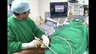 Treatment of Varicose Veins with Radio Frequency Ablation RFA Dr Shoaib Padaria [upl. by Hermosa]