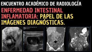 IX Encuentro Académico de Radiología Enfermedad intestinal inflamatoria [upl. by Nnylyrehc]