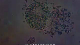 Fresh Water Oodinium cysts crack [upl. by Aseret681]