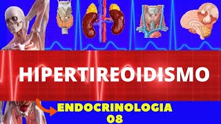 HIPERTIREOIDISMO CAUSAS SINTOMAS DIAGNÓSTICO E TRATAMENTO  ENDOCRINOLOGIA [upl. by Anitselec845]