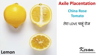 Axile Placentation Explained NBD1 kexam NEET [upl. by Kalb]