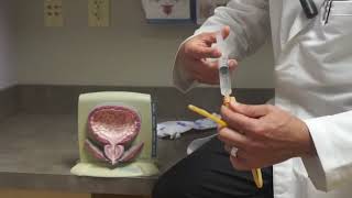 How a Bladder Catheter Works [upl. by Drofiar]