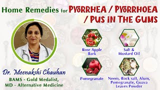 Home Remedies for Pyorrhea  Pyorrhoea  Pus in The Gums [upl. by Estelle]