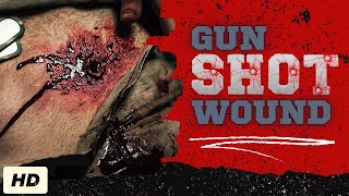 Gunshot Wound Everything You Need To Know [upl. by Kiyoshi916]