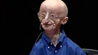 My philosophy for a happy life  Sam Berns  TEDxMidAtlantic [upl. by Robet551]