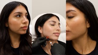 Don’t do Kybella Do Jaw Contouring with Botox  Filler Dani Rios [upl. by Williams]