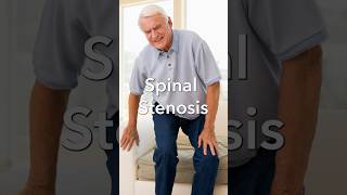 What Causes Spinal Stenosis [upl. by Lehcsreh21]